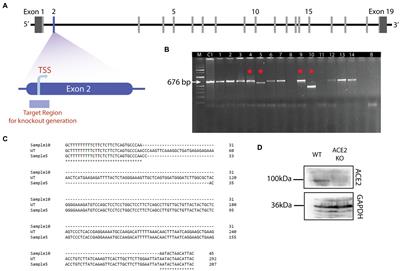 Knockout of angiotensin converting enzyme-2 receptor leads to morphological aberrations in rodent olfactory centers and dysfunctions associated with sense of smell